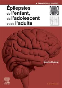 Epilepsies de l'enfant, de l'adolescent et de l'adulte : de la physiopathologie à la prise en charge