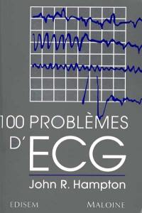 L'ECG facile