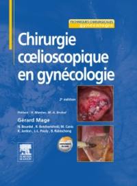 Chirurgie coelioscopique en gynécologie