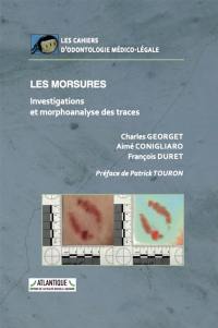 Les morsures : investigations et morphoanalyse des traces