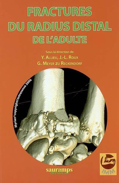 Fractures du radius distal de l'adulte