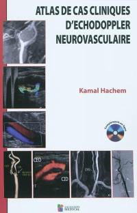 Atlas de cas cliniques d'échodoppler neurovasculaire