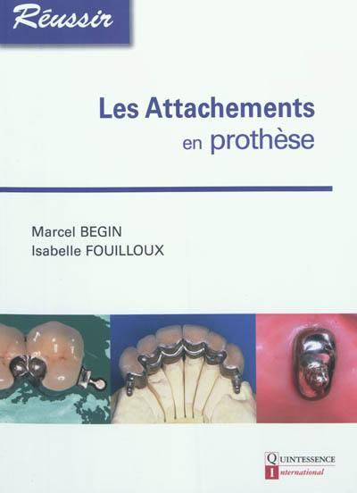 Les attachements en prothèse