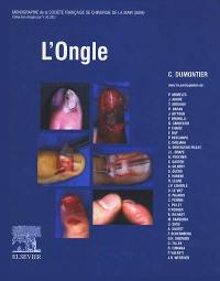 L'ongle