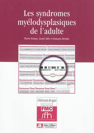 Les syndromes myélodysplasiques de l'adulte